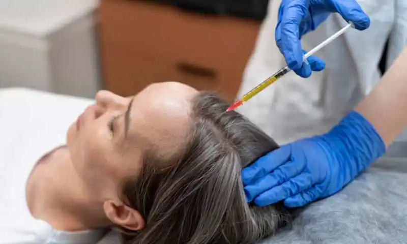 PRP treatment for hair regrowth showing scalp injection procedure