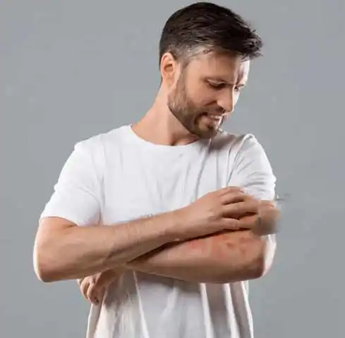 Fungal Specialist Doctor in South Delhi, Delhi